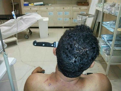 Homem ficou com faca cravada na cabeça em Agudos