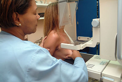 Foram realizados 185 consultas médicas em mastologia