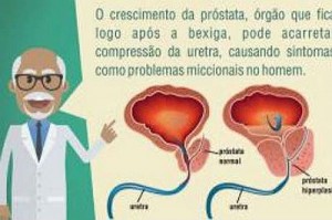 Sociedade Brasileira de Urologia faz um alerta à população masculina sobre o aumento da próstataDivulgação/Sociedade Brasileira de Urologia