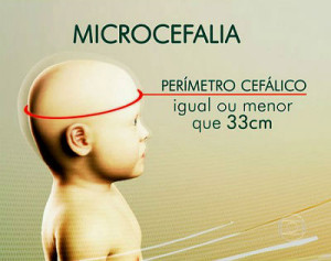 Zika Vírus pode ser o causador do aumento dos casos de microcefalia (Foto: Ilustração)