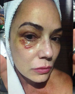 Atriz acusa ex-marido de tê-la agredido com um soco após uma discussão