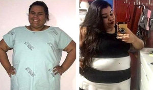 Segundo a irmã da jovem, Amanda era vítima de bullying desde a infância e decidiu fazer a intervenção cirúrgica