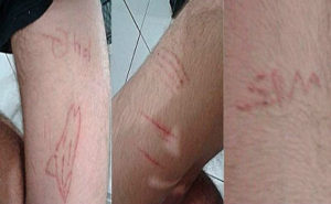 Adolescente de 16 anos teve ataque de raiva após celular quebrar e ameaçou agredir pai com faca